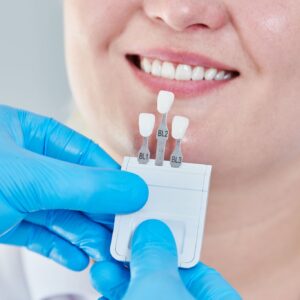 ARE YOU A CANDIDATE FOR PORCELAIN VENEERS?