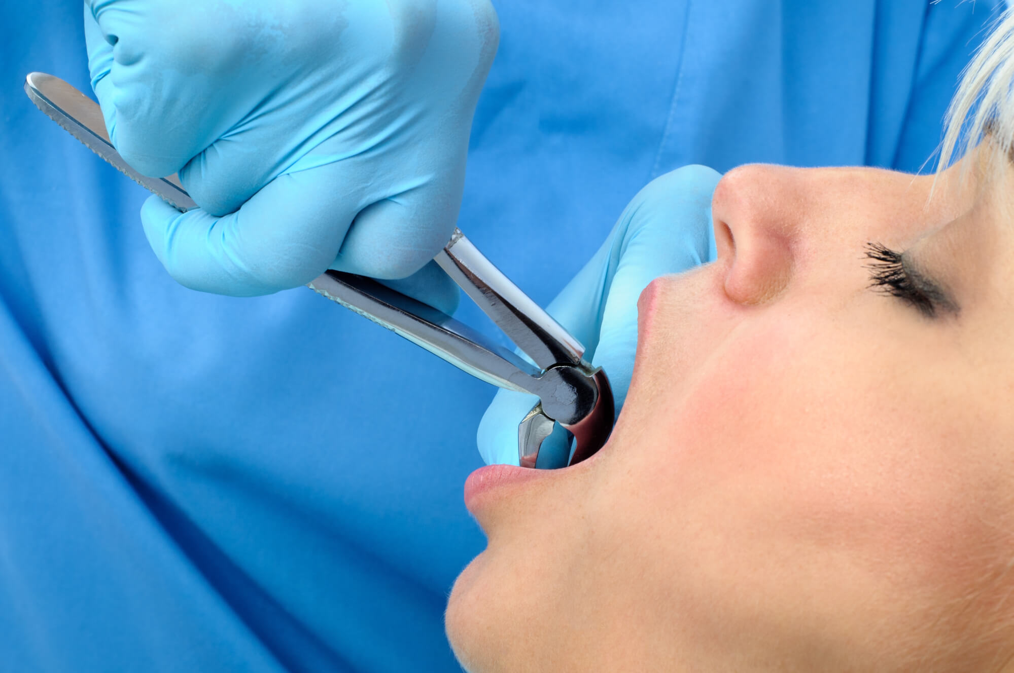 Patient undergoing wisdom teeth removal in Las Vegas NV