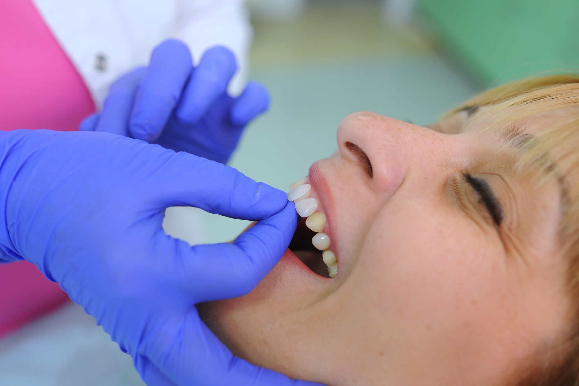 blonde patient trying on a sample of dental veneers las vegas