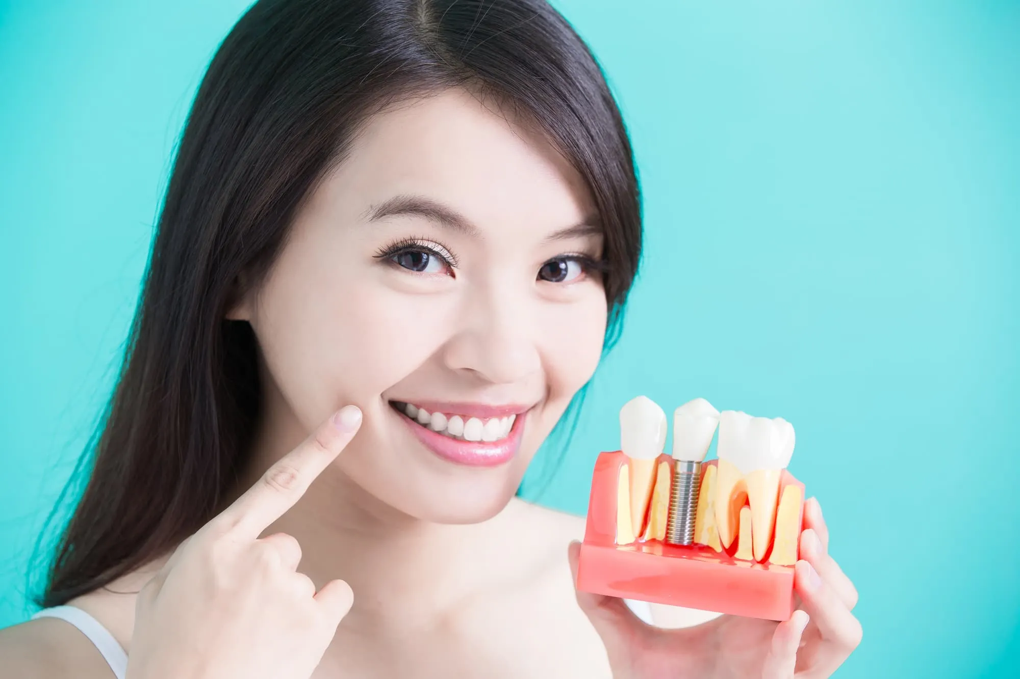 Get the best dental implants in Summerlin