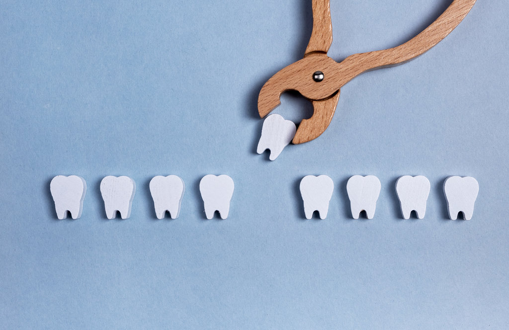 Surgical tooth extraction, removal procedure with forceps. Decayed root, gum diseases consequences. Dental health concept. Kids toy. High quality photo
