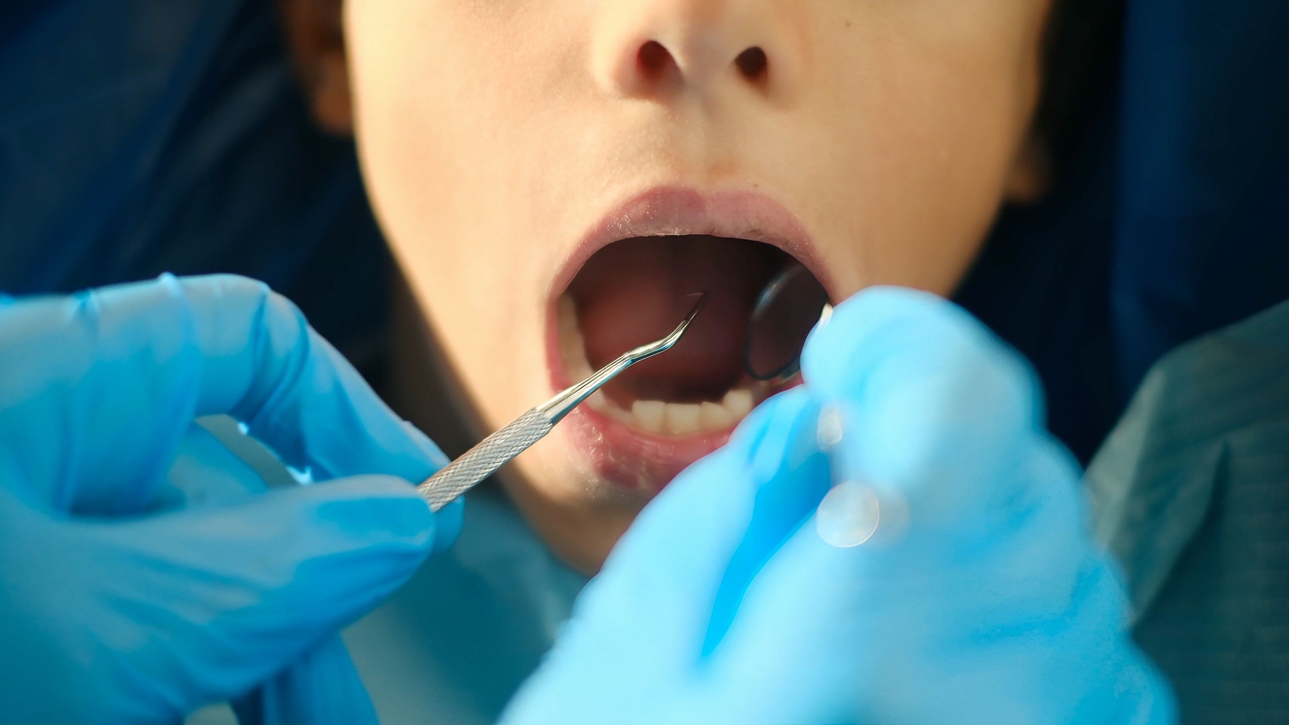 Dentist examining patient's open mouth with a dental mirror and probe, checking teeth and gums during a routine oral hygiene check-up focused on health and prevention